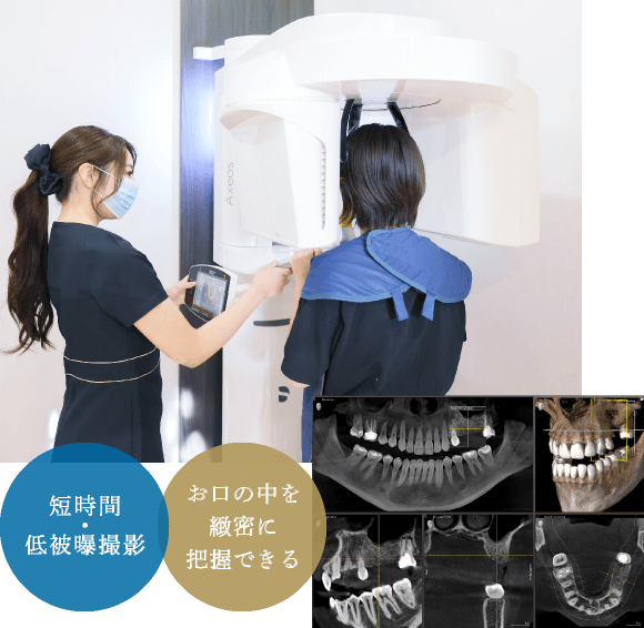 短時間・低被曝撮影/お口の中を緻密に把握できる