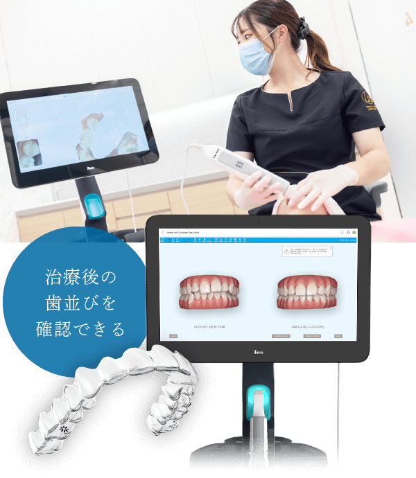 治療後の歯並びを確認できる